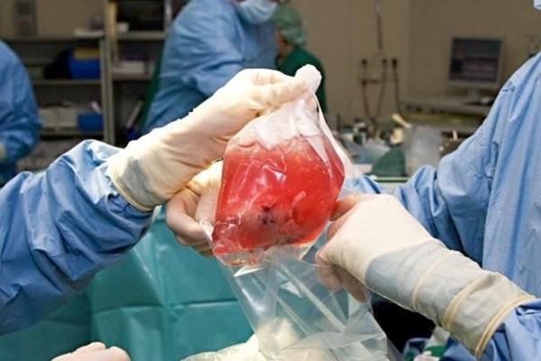 Буковинці зможуть після смерті віддати свої органи на трансплантацію