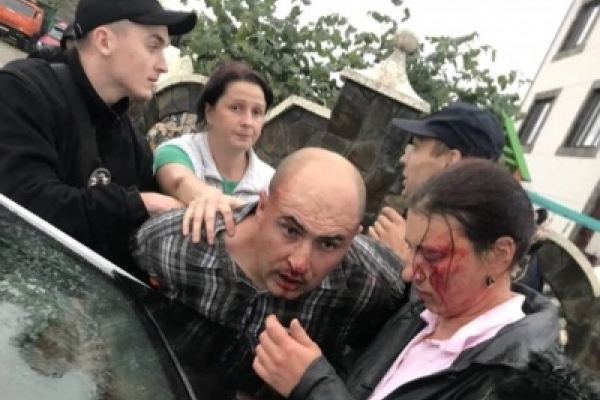 У поліції Чернівців розповіли чому затримали агресивного водія