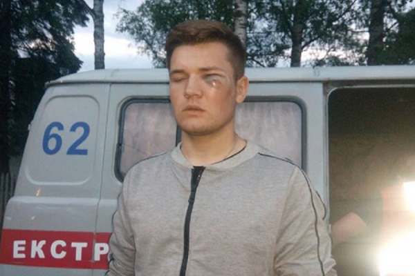 Стріляли по ногах, - постраждалий хлопець з Путильщини розповів подробиці