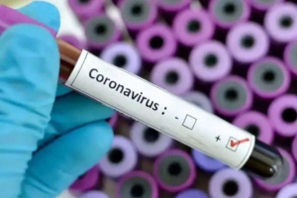 Куди витрачають кошти, виділені на протидію коронавірусу на Буковині?