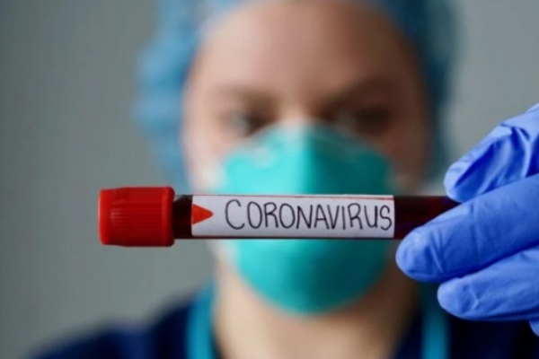 У трьох хворих на коронавірус буковинців пневмонія