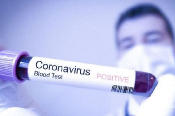Вже 38 випадків інфікування COVID-19 зафіксовано на Буковині. Що відомо про стан хворих?