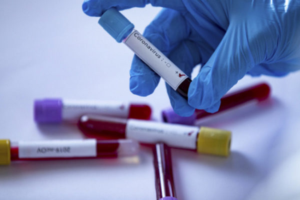 На Буковині виявили 23 нових випадки коронавірусу