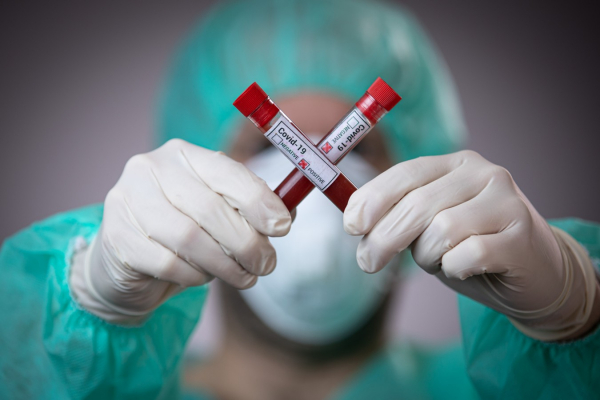 Знову антирекорди: за добу на Буковині виявлено 486 нових випадків коронавірусу та 11 смертей