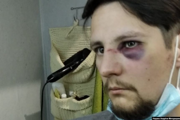 Поліцейський з Чернівців жорстоко побив ветерана АТО у Львові