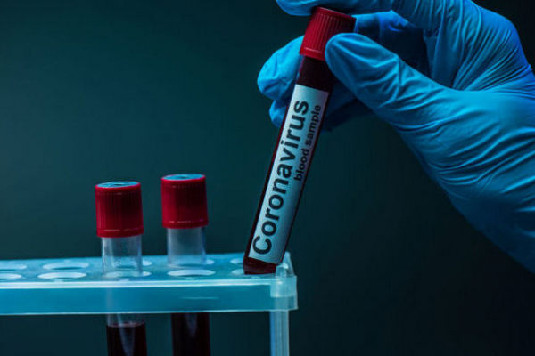 На Буковині виявлено нові випадки коронавірусу